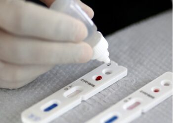 Goianos podem fazer permuta para pagar exames de Covid-19