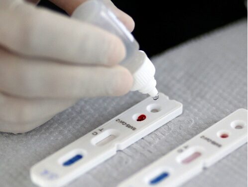 Goianos podem fazer permuta para pagar exames de Covid-19