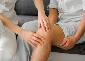 SBCP/GO esclarece sobre trombose venosa profunda e cirurgia plástica